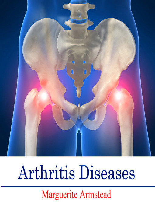 Title details for Arthritis Diseases by Marguerite Armstead - Available